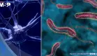 Científicos descubren que una proteína del cólera podría provocar la autodestrucción de células de cáncer