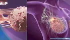 Alerta por aumento de cáncer de mama lobulillar: Crece tres veces más rápido que otros tipos en EE.UU