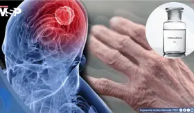 Descubren que este químico industrial común podría aumentar el riesgo de padecer párkinson 