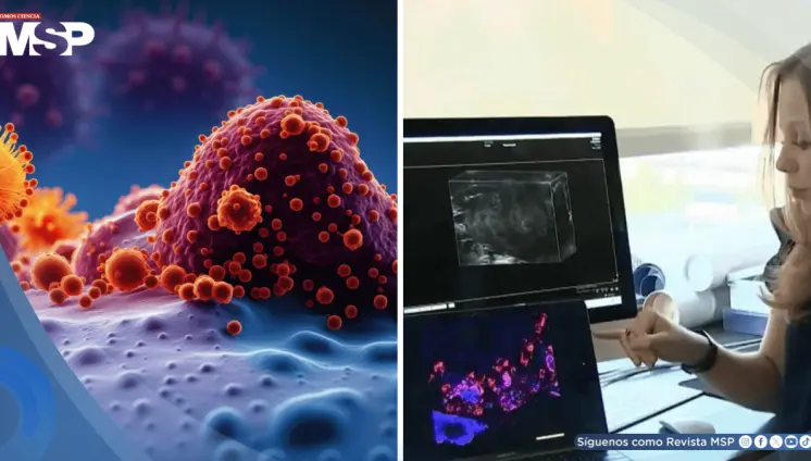 Desarrollan vacuna que lograría prevenir el melanoma, cáncer de páncreas y el de mama triple negativo