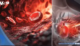 Investigadores descubren que esta proteína podría provocar arritmias mortales tras un infarto 