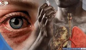 Fumar aumentar&iacute;a el riesgo de ceguera: el da&ntilde;o ser&iacute;a irreversible incluso luego de dejar el cigarrillo