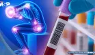 Desarrollan test sanguíneo que podría detectar síndrome de fatiga crónica con 96% de precisión