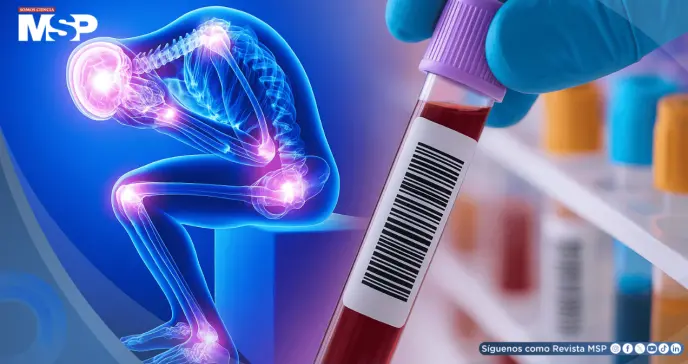 Desarrollan test sanguíneo que podría detectar síndrome de fatiga crónica con 96% de precisión