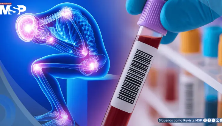 Desarrollan test sanguíneo que podría detectar síndrome de fatiga crónica con 96% de precisión