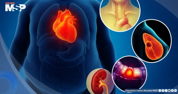 Alertan sobre el aumento de cánceres relacionados con la obesidad en jóvenes y adultos: Estudio