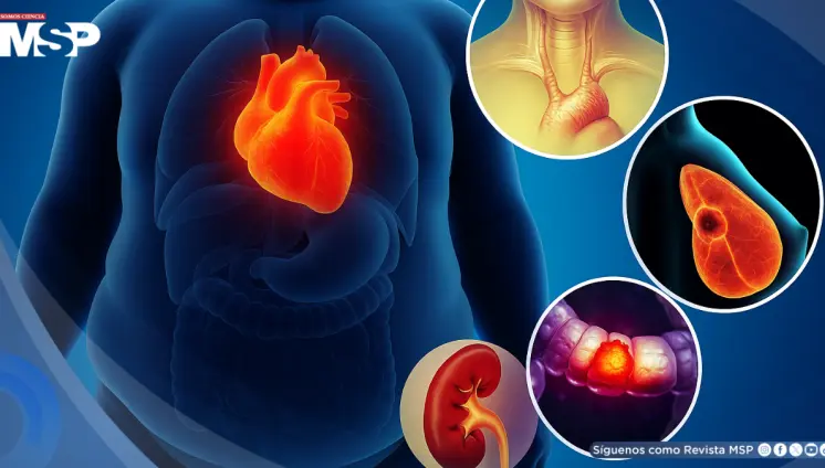 Alertan sobre el aumento de cánceres relacionados con la obesidad en jóvenes y adultos: Estudio