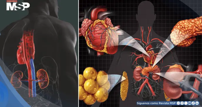 Qué es el síndrome cardiovascular renal-metabólico, que podría afectar a 9 de cada 10 adultos