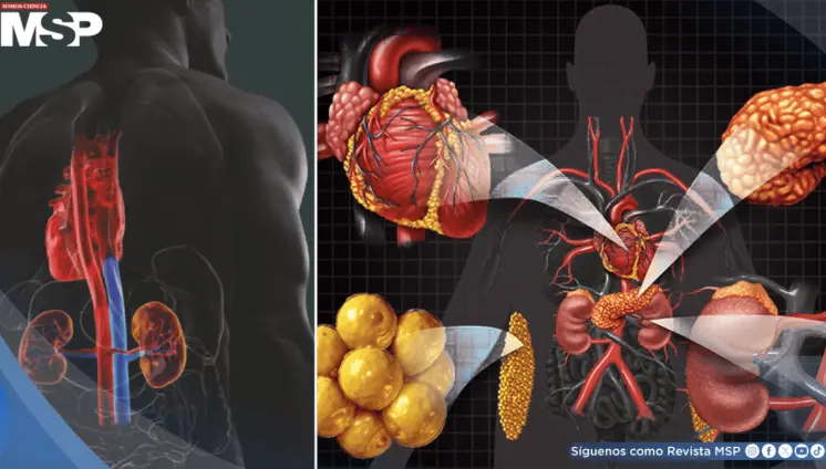 Qué es el síndrome cardiovascular renal-metabólico, que podría afectar a 9 de cada 10 adultos