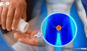 Nueva terapia combinada reduce más del 40% el riesgo de muerte por cáncer de próstata recurrente