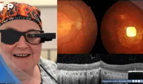 Desarrollan implante fotovoltaico que devuelve la capacidad de leer a personas con degeneración macular