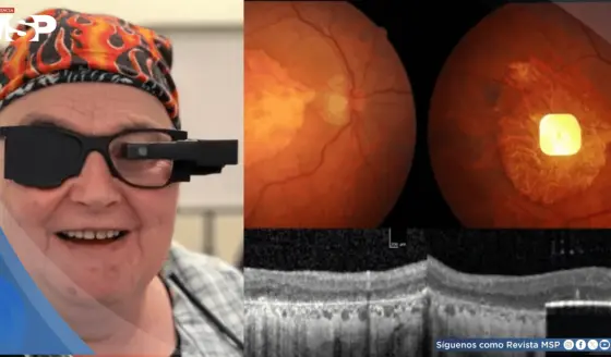 Desarrollan implante fotovoltaico que devuelve la capacidad de leer a personas con degeneración macular