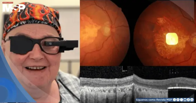 Desarrollan implante fotovoltaico que devuelve la capacidad de leer a personas con degeneración macular