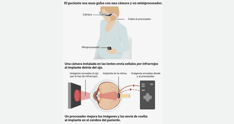 imagen-cuerpo
