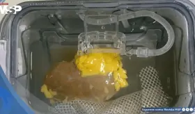 Científicos crean el primer "riñón universal" que podría ser compatible con cualquier tipo de sangre