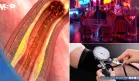 El alcohol elevaría la presión arterial incluso en consumo moderado, confirma estudio