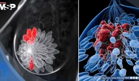Desarrollan terapia de anticuerpos que activa el sistema inmune y frena el cáncer de mama triple negativo