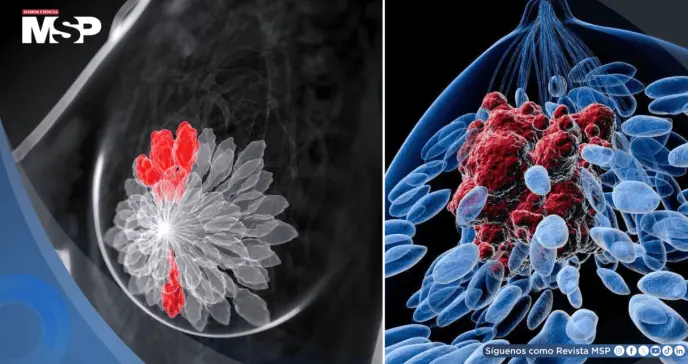 Desarrollan terapia de anticuerpos que activa el sistema inmune y frena el cáncer de mama triple negativo Desarrollan terapia de anticuerpos que activa el sistema inmune y frena el cáncer de mama triple negativo