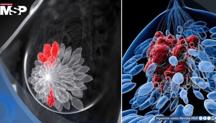 Desarrollan terapia de anticuerpos que activa el sistema inmune y frena el cáncer de mama triple negativo