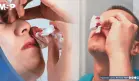 Por qué nunca debe inclinar la cabeza hacia atrás durante una hemorragia nasal