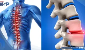 Quiropraxia: Qué es, cómo funciona y qué dice la ciencia sobre su efectividad y seguridad