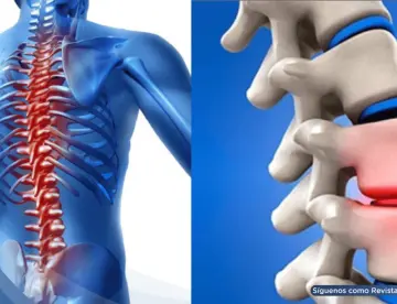 Quiropraxia: Qué es, cómo funciona y qué dice la ciencia sobre su efectividad y seguridad