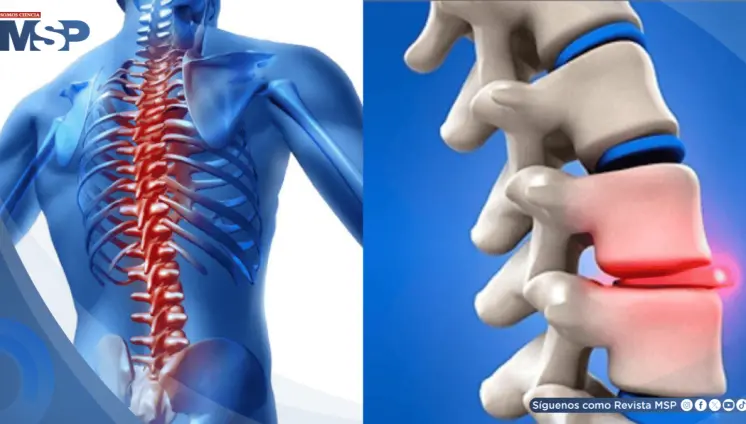 Quiropraxia: Qué es, cómo funciona y qué dice la ciencia sobre su efectividad y seguridad