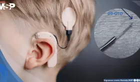 Once niños con sordera recuperan la audición gracias a terapia génica pionera