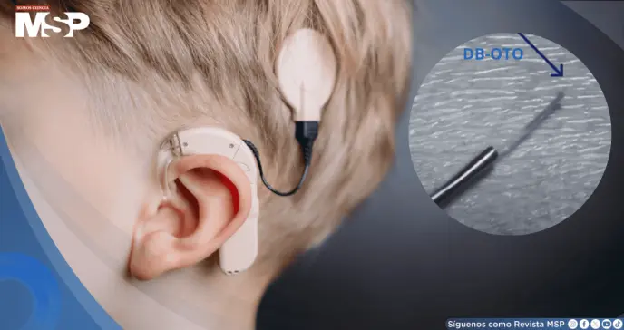 Once niños con sordera recuperan la audición gracias a terapia génica pionera Once niños con sordera recuperan la audición gracias a terapia génica pionera