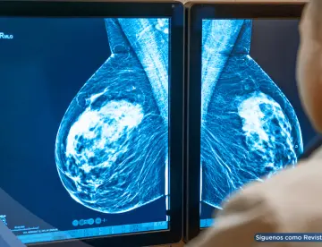 Algoritmo con inteligencia artificial detectaría el cáncer de mama antes de su aparición en la mamografía