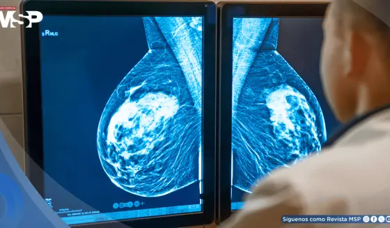 Algoritmo con inteligencia artificial detectaría el cáncer de mama antes de su aparición en la mamografía