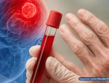 Nuevo análisis de sangre podría detectar el párkinson en fases tempranas, según investigadores