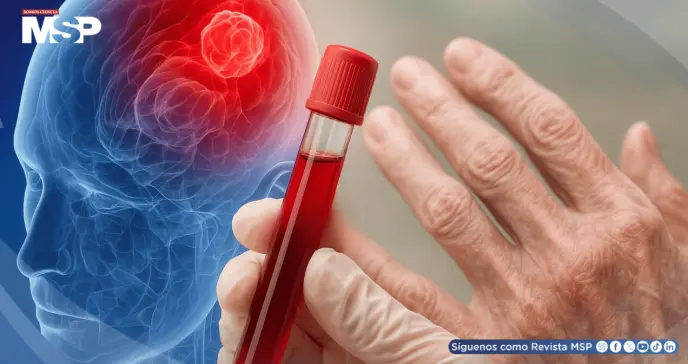 Nuevo análisis de sangre podría detectar el párkinson en fases tempranas, según investigadores Nuevo análisis de sangre podría detectar el párkinson en fases tempranas, según investigadores