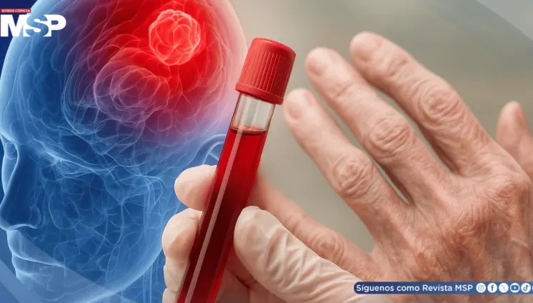 Nuevo análisis de sangre podría detectar el párkinson en fases tempranas, según investigadores