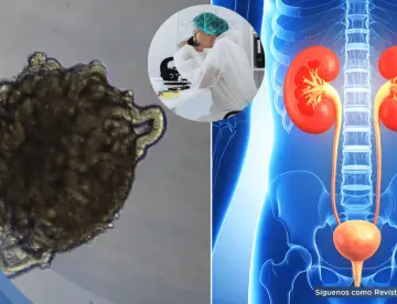 Crean riñones de cerdo con células humanas: Reducirían espera de trasplantes y regeneran órganos dañados