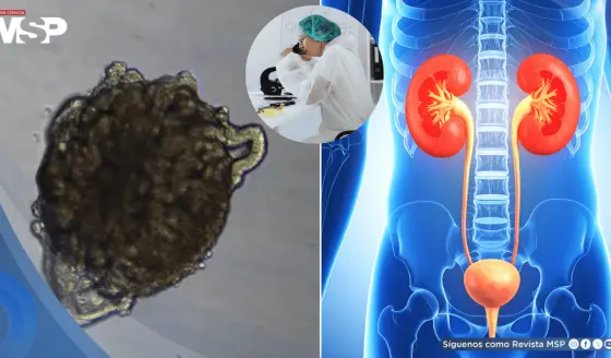 Crean riñones de cerdo con células humanas: Reducirían espera de trasplantes y regeneran órganos dañados