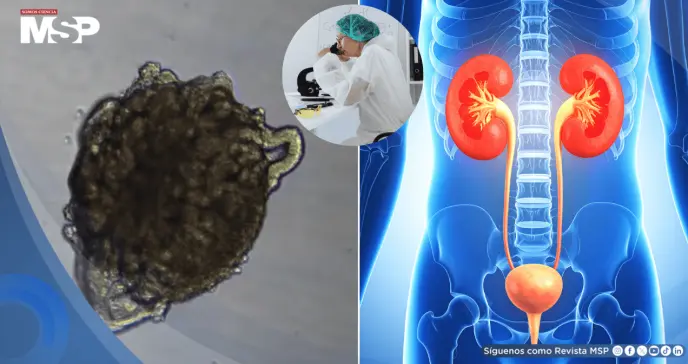 Crean riñones de cerdo con células humanas: Reducirían espera de trasplantes y regeneran órganos dañados Crean riñones de cerdo con células humanas: Reducirían espera de trasplantes y regeneran órganos dañados