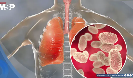 Tos convulsa: Cómo reconocer la enfermedad y prevenirla ante el aumento de incidencia 