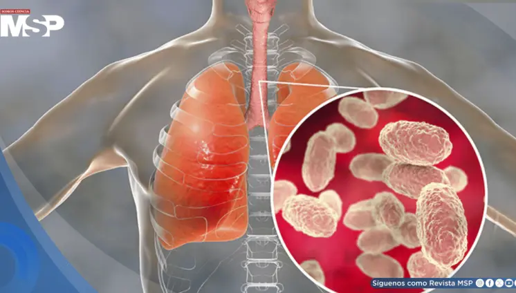 Tos convulsa: Cómo reconocer la enfermedad y prevenirla ante el aumento de incidencia 