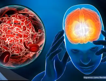 Descubren que el DMT podría proteger contra el daño cerebral tras un accidente cerebrovascular