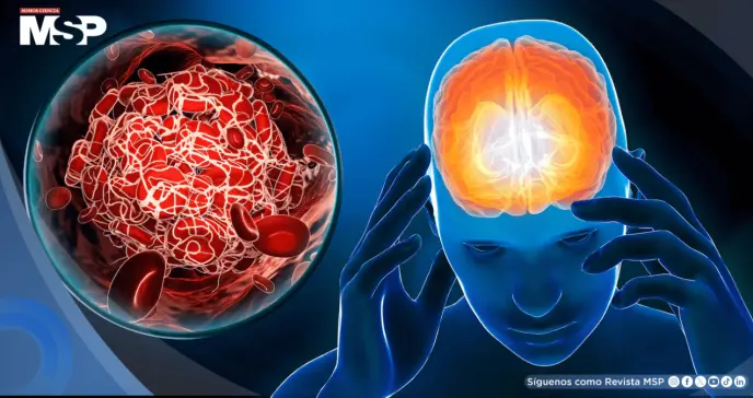 Descubren que el DMT podría proteger contra el daño cerebral tras un accidente cerebrovascular Descubren que el DMT podría proteger contra el daño cerebral tras un accidente cerebrovascular
