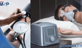 El uso del CPAP podría prevenir la hipertensión en pacientes con apnea del sueño, revela estudio