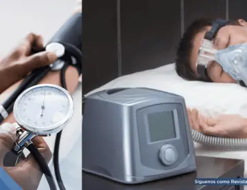 El uso del CPAP podría prevenir la hipertensión en pacientes con apnea del sueño, revela estudio