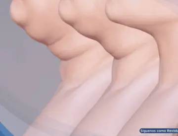 Tu cuello habla de tu salud: Su grosor puede revelar exceso de grasa y riesgo de enfermedades silenciosas
