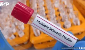 Nuevo test de sangre podría detectar esclerosis múltiple antes de los daños neurológicos