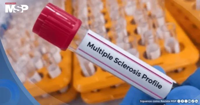 Nuevo test de sangre podría detectar esclerosis múltiple antes de los daños neurológicos