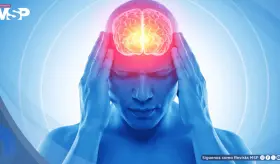 Cefalea por abuso de analgésicos: qué es, por qué ocurre y cómo detectar las señales a tiempo