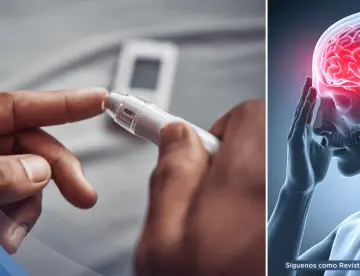 La diabetes podría aumentar el riesgo de demencia: Afecta al cerebro por inflamación y cambios en glucosa