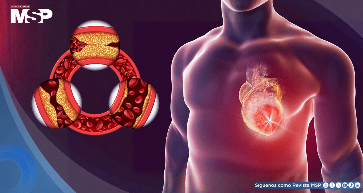 La genética podría aumentar el riesgo de enfermedades cardíacas aunque se lleve estilo de vida saludable