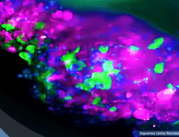 Así se detecta el cáncer en estadio 0: Ofrece supervivencia del 99 % si se diagnostica a tiempo